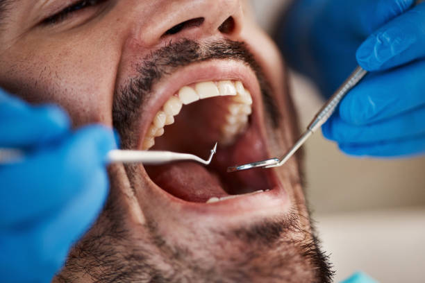 Trusted MI Emergency Dentist Experts